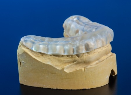 Model of jaw with clear nightguard over the teeth