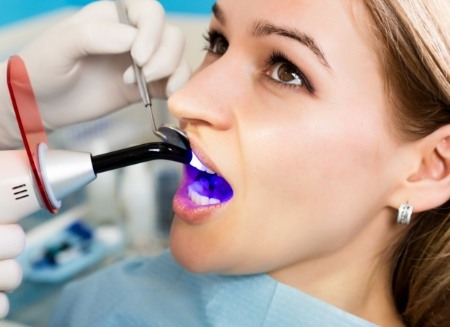 Woman getting direct bonding on her front tooth