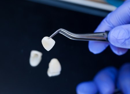 Dentist holding a Lumineer in tweezers