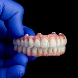 Dentist holding an implant denture