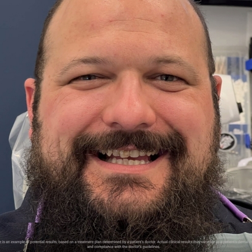 Bearded man smiling with imperfect teeth