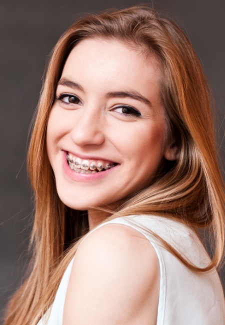 Young woman smiling with braces in Sachse