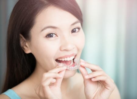 Woman placing Invisalign aligner over her teeth