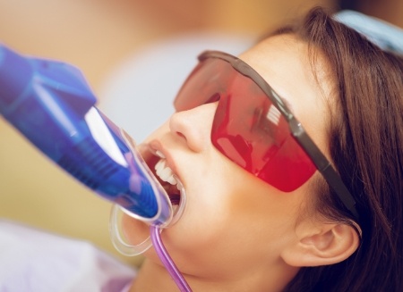 Girl ind ental chair with fluoride trays over her teeth