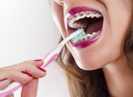 Woman with braces brushing her teeth