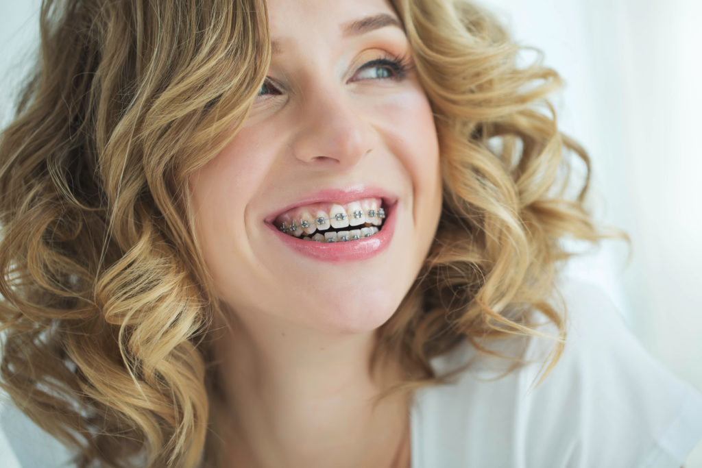 Smiling woman in metal braces