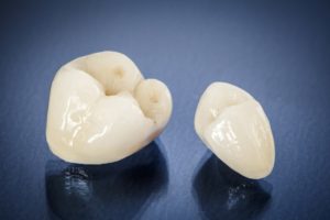 All-ceramic dental crowns from digital impressions in Sachse