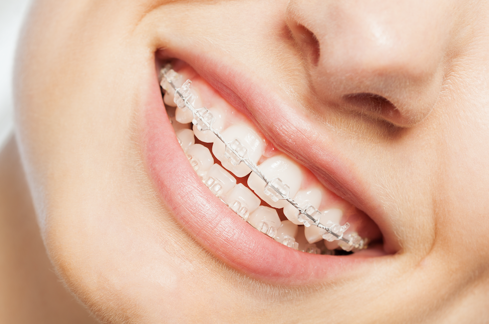 cost of orthodontic treatment sachse