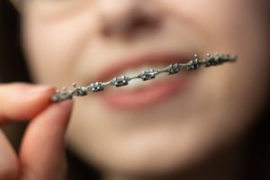 a person getting their braces successfully removed at the dentist