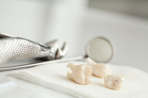 Three extracted teeth lying on a cloth next to dental instruments